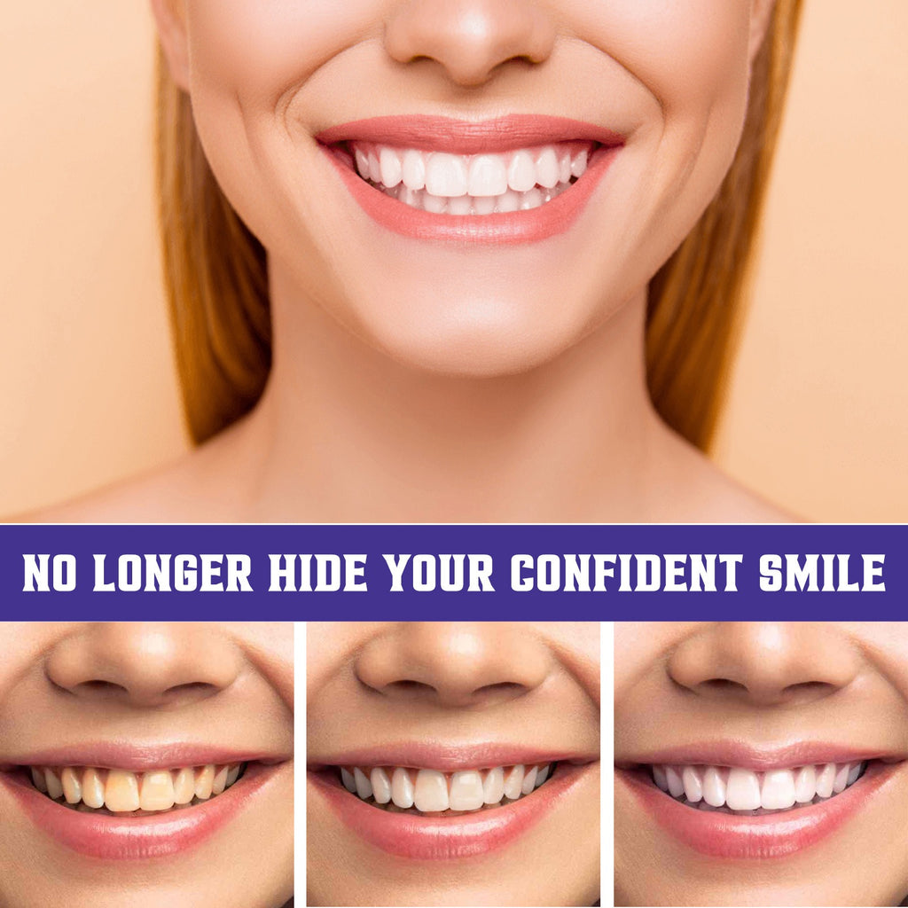 Purple Teeth Whitening Toothpaste 30ml – Fresh Breath Whitening Toothpaste Oasis Select