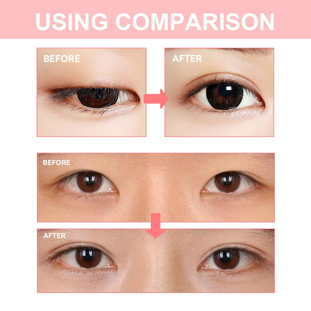 Double Eyelid Shaping Cream – Hyaluronic Acid & Vitamin E Eyelid Shaping Cream Oasis Select
