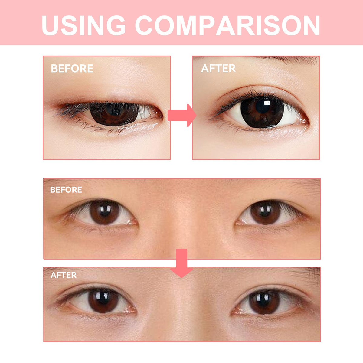 Double Eyelid Shaping Cream – Hyaluronic Acid & Vitamin E Eyelid Shaping Cream Oasis Select