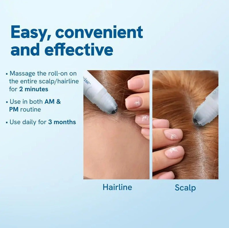 Rosemary Hair Growth Essence Roll-On | Scalp Hair Oil 25ml Hair Growth Essence Oasis Select