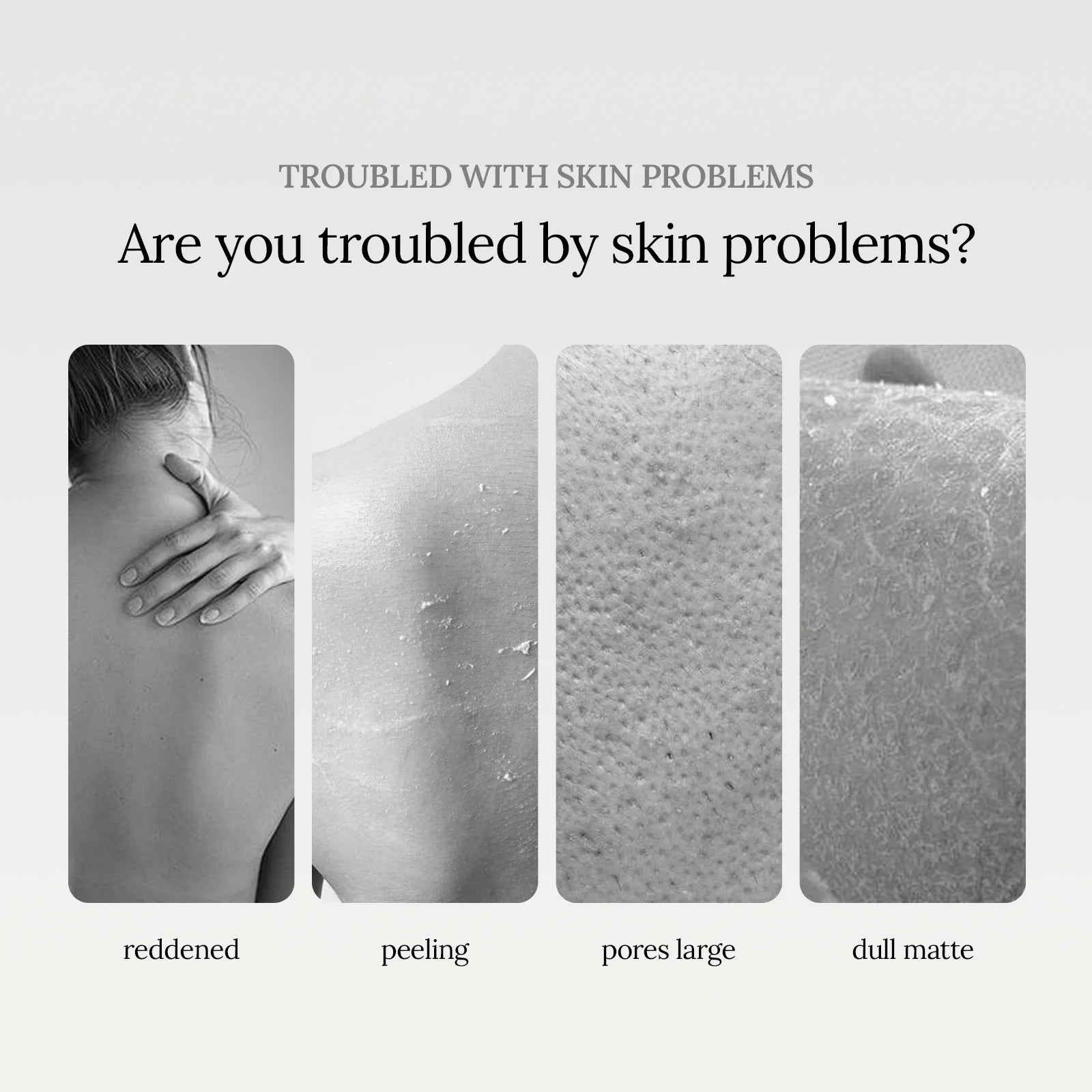 100ML Niacinamide Body Shower Gel Gentle Cleaning Skin Remove Dead Skin Pore Shrink Enhance Smoothness Glowing Body Washing Gel Oasis Select