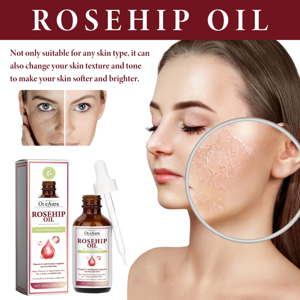 Oceaura Rosehip Oil Face Serum Fade Fine Lines Moisturizing Remove Wrinkles Improve Skin Elasticity Firming Facial Serum Oasis Select