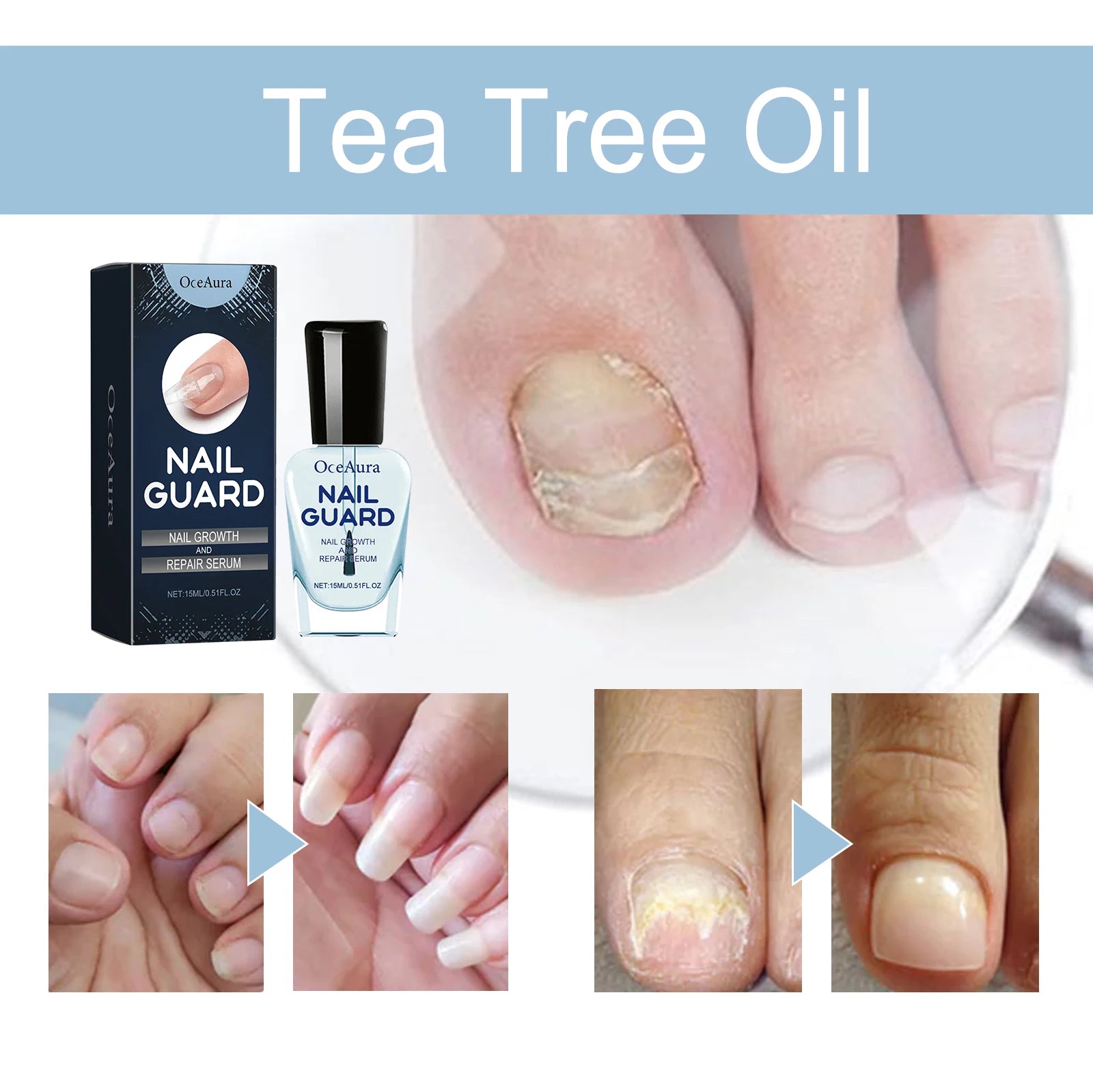 Natual Nail Care Serum Deeply Nourishing Repair Damaged Nail Maintain Beauty Nails Enhance Natural Shine Nail Nourishing Oil Oasis Select
