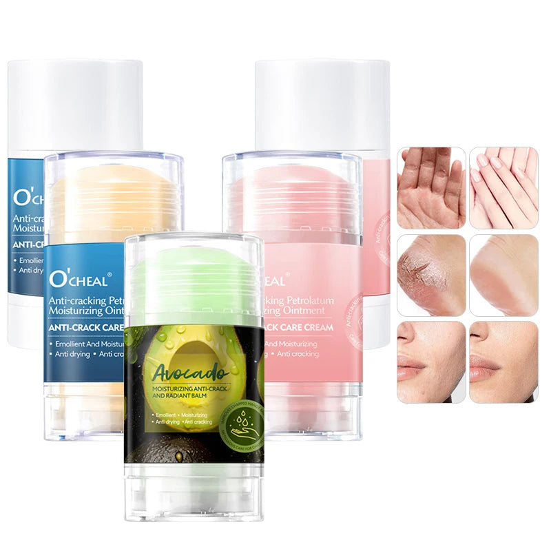 O’CHEAL 40g Foot Skin Care Cream Stick Nourishing Cream Hand Facial Cream Removal Dead Skin Moisturizing Hand Feet Gel Skin Care Oasis Select