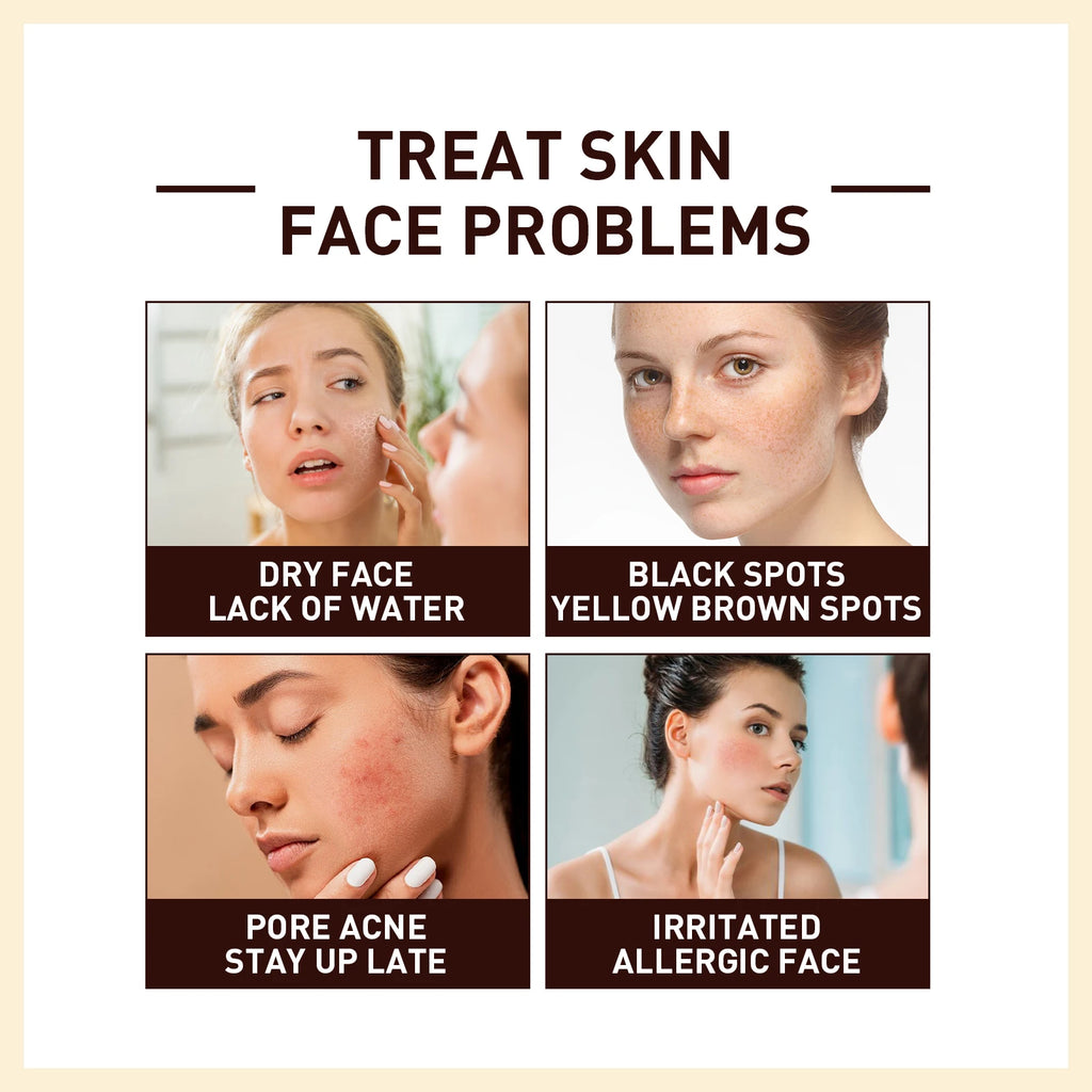 30ML Rice Facial Serum Long Lasting Moisturizing Improve Roughness Reduce Dullness Softening Boosts Elasticity Face Care Serum Oasis Select
