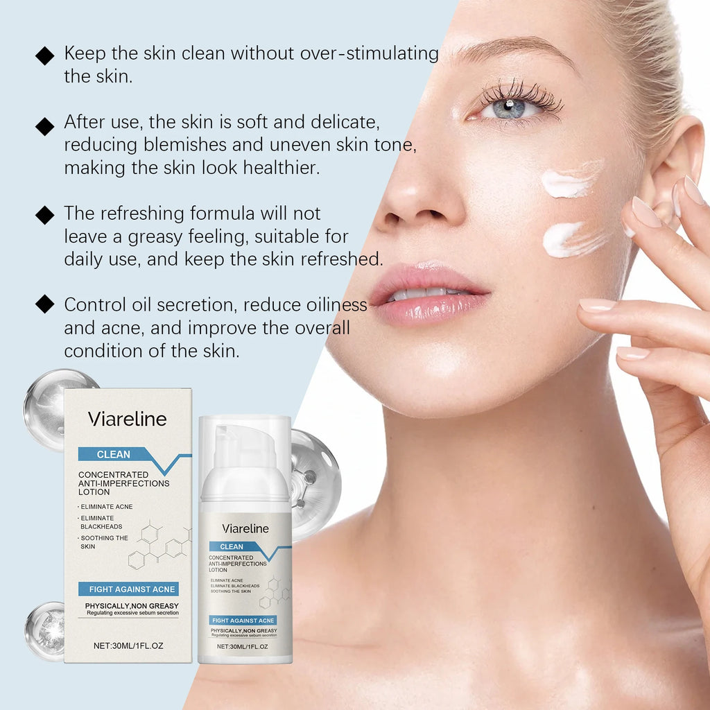 Viareline Salicylic Acid Acne Lotion – Clear Blackheads 30ml Acne Care Lotion Oasis Select