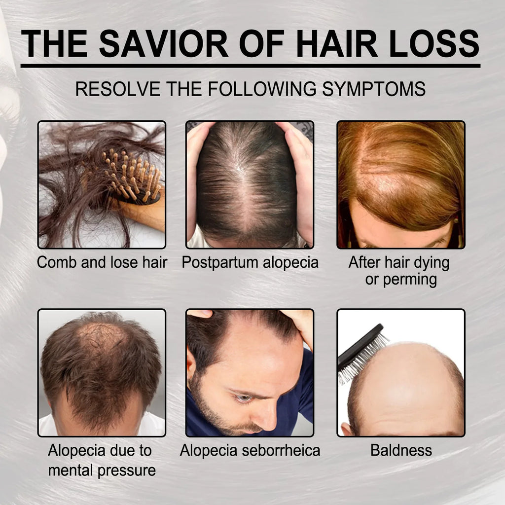 Jaysuing Hair Growth Set – Loss Treatment, Wax & Shampoo Hair Growth Set Oasis Select