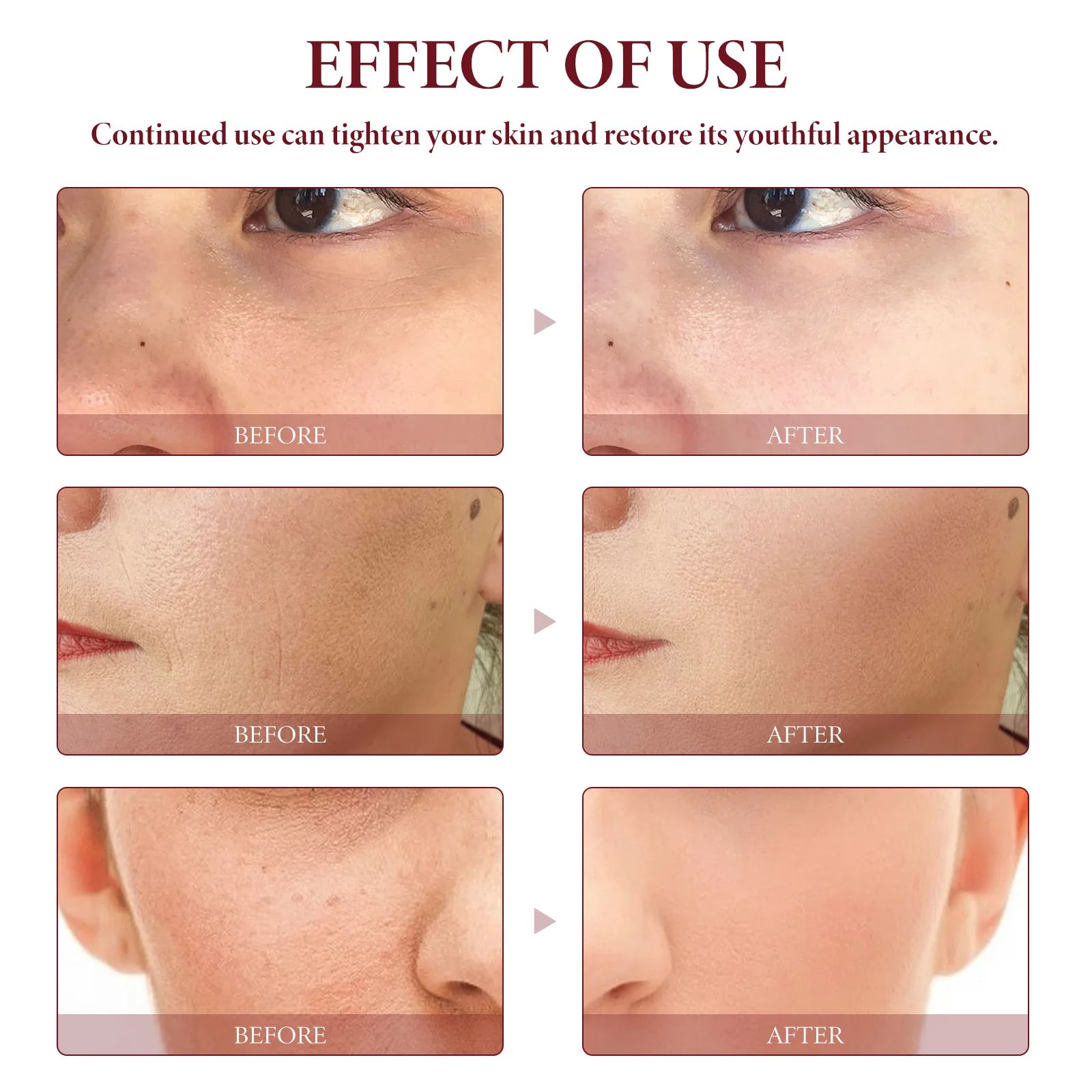 Oceaura Rosehip Oil Face Serum Fade Fine Lines Moisturizing Remove Wrinkles Improve Skin Elasticity Firming Facial Serum Oasis Select