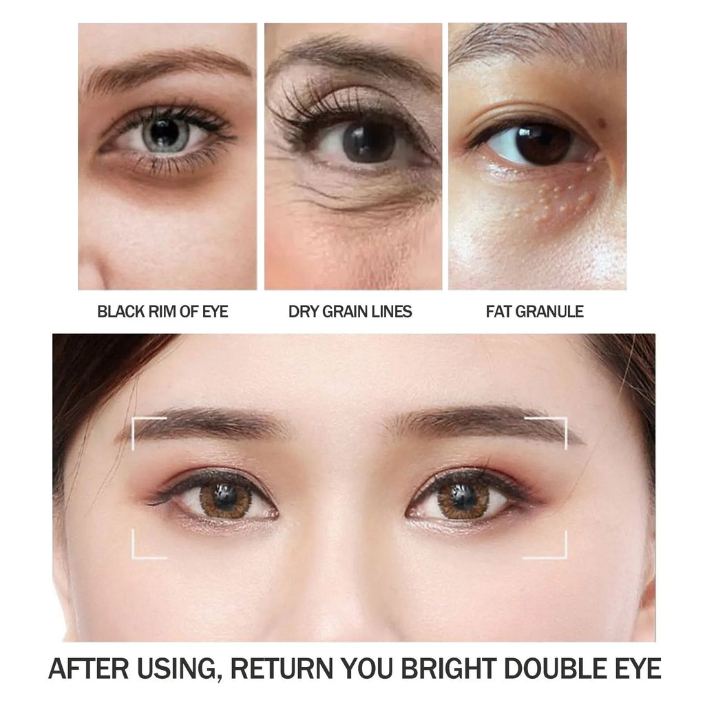 Anti Dark Circle Eye Cream Anti Puffiness Firming Skin Lighten Massage Essence Skin Care Instant Eye Bag Removal Cream New 2024 Oasis Select