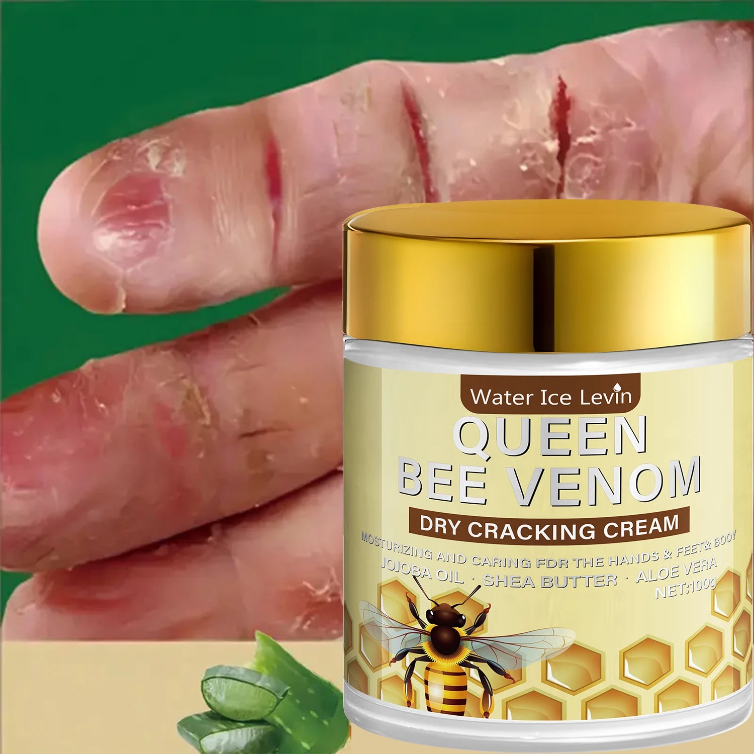 Bee Venom Cream with Retinol & Niacinamide – Dry Cracked Skin Body Repair Cream Oasis Select