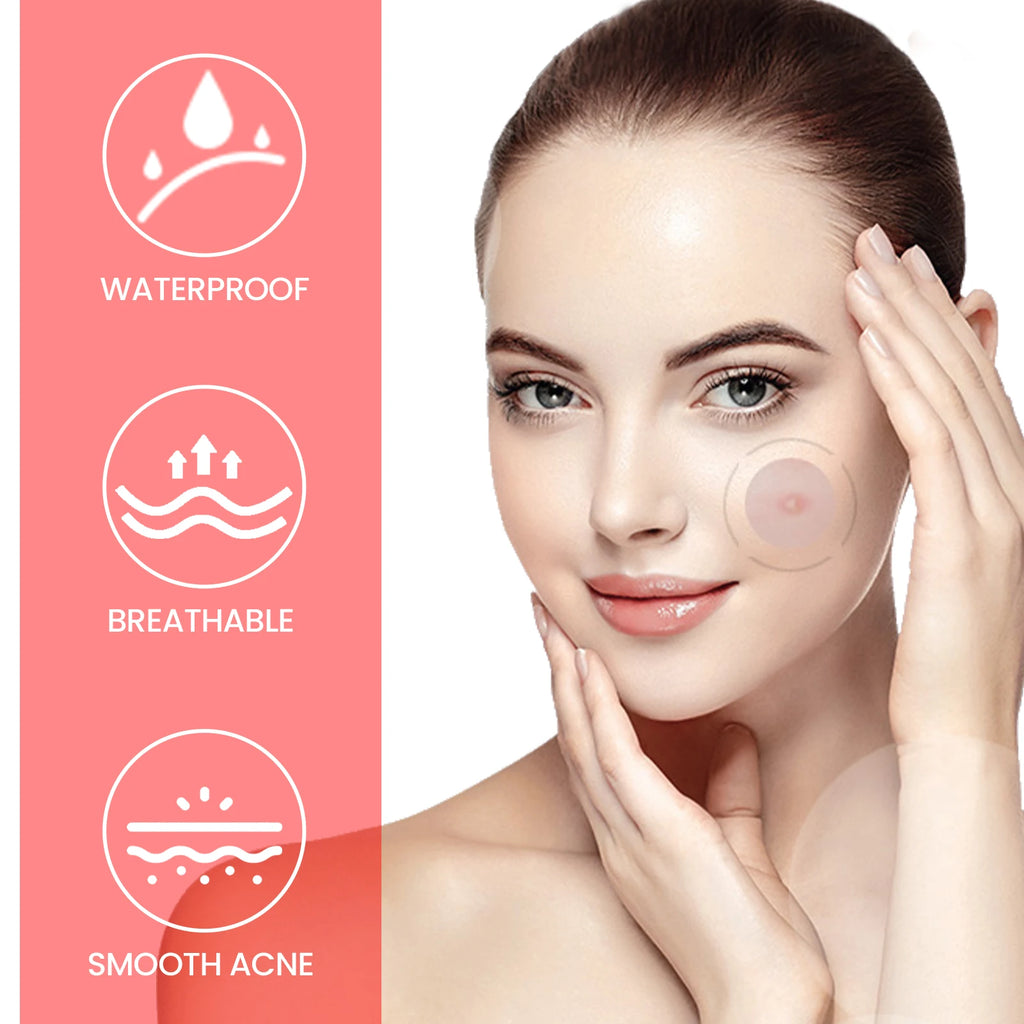 Jaysuing 200pc Pimple Patches – Waterproof Deep Clean Acne Patch