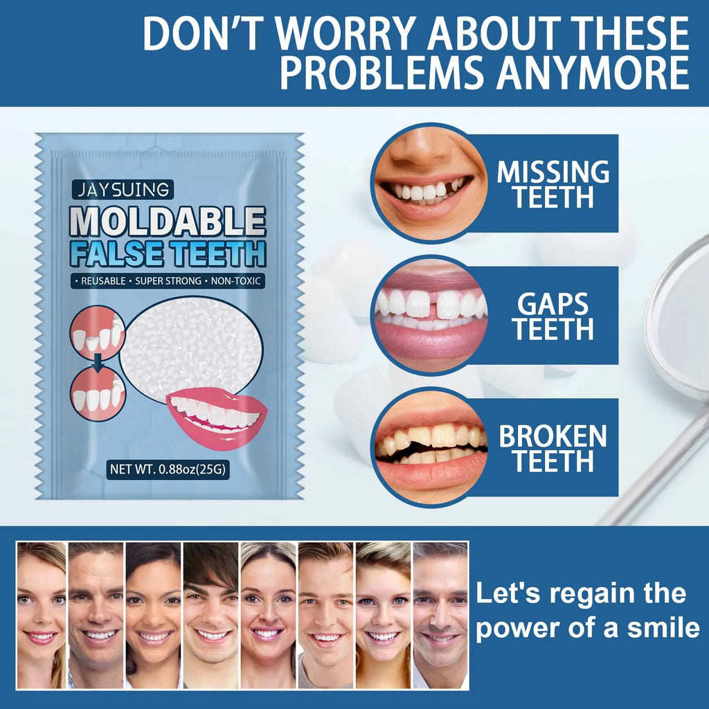 Moldable Temporary Tooth Repair Kit – Dental Adhesive 25g Dental Repair Kit Oasis Select