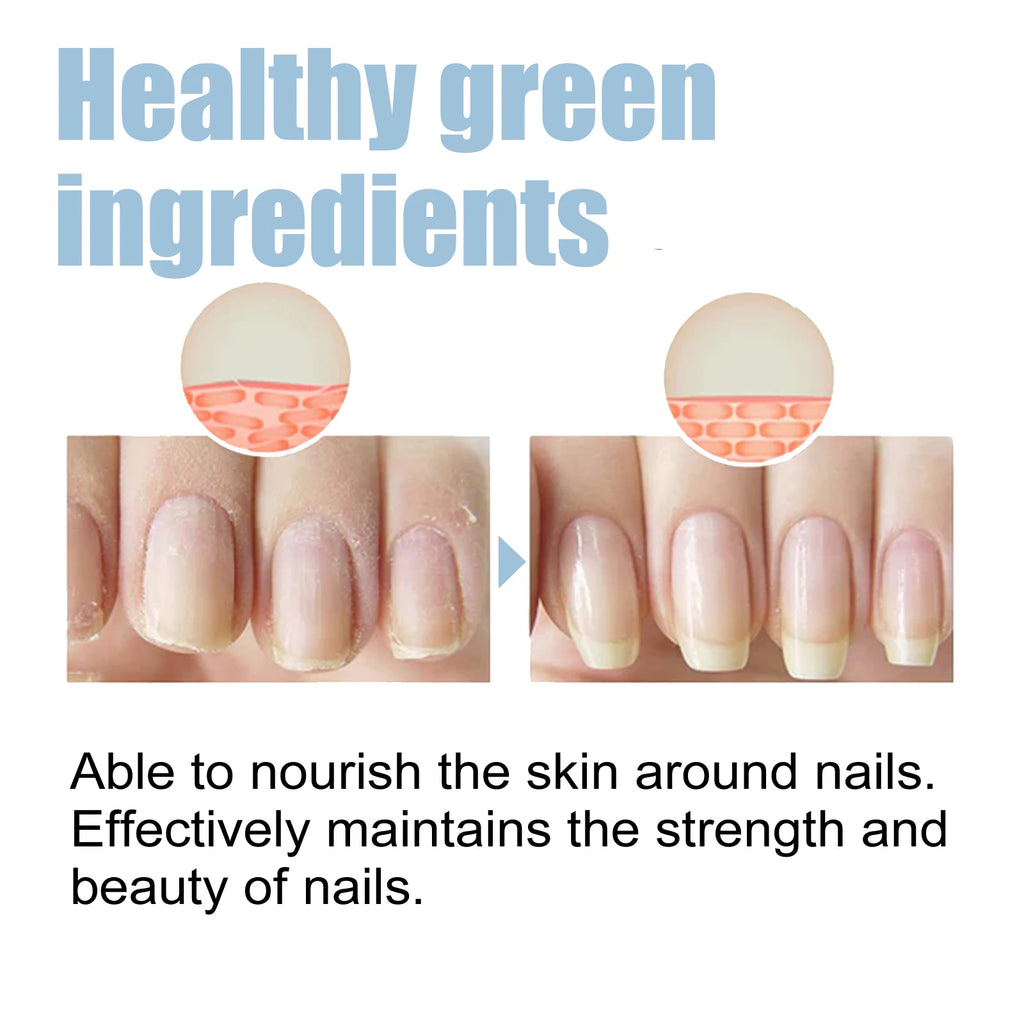 Natual Nail Care Serum Deeply Nourishing Repair Damaged Nail Maintain Beauty Nails Enhance Natural Shine Nail Nourishing Oil Oasis Select