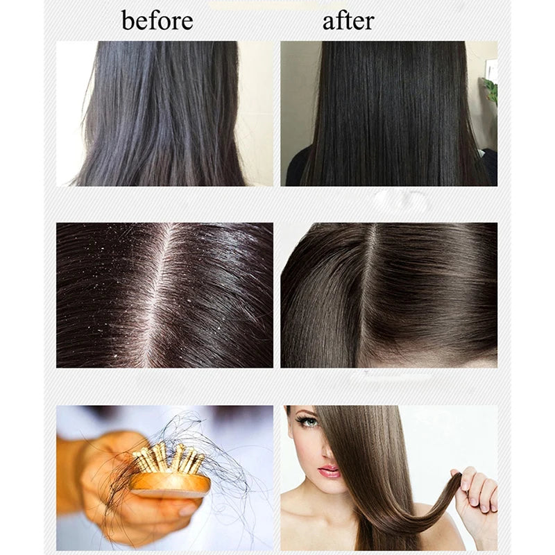 BOQIAN Ginger Shampoo & Conditioner Set 500ml – Anti Hair Loss Hair Care Set Oasis Select