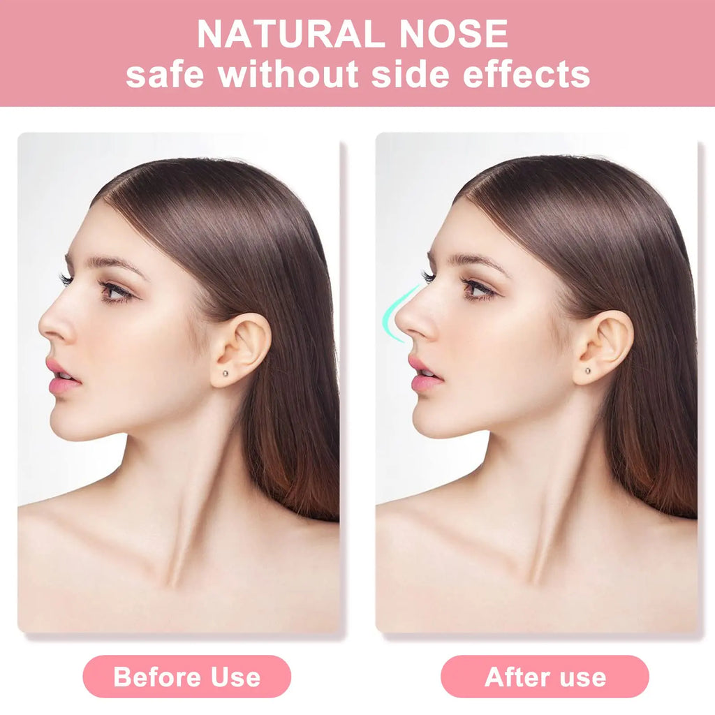 Nose Shaper Lifting Clips – 2 Sets, 3 Sizes | Silicone & Acrylic