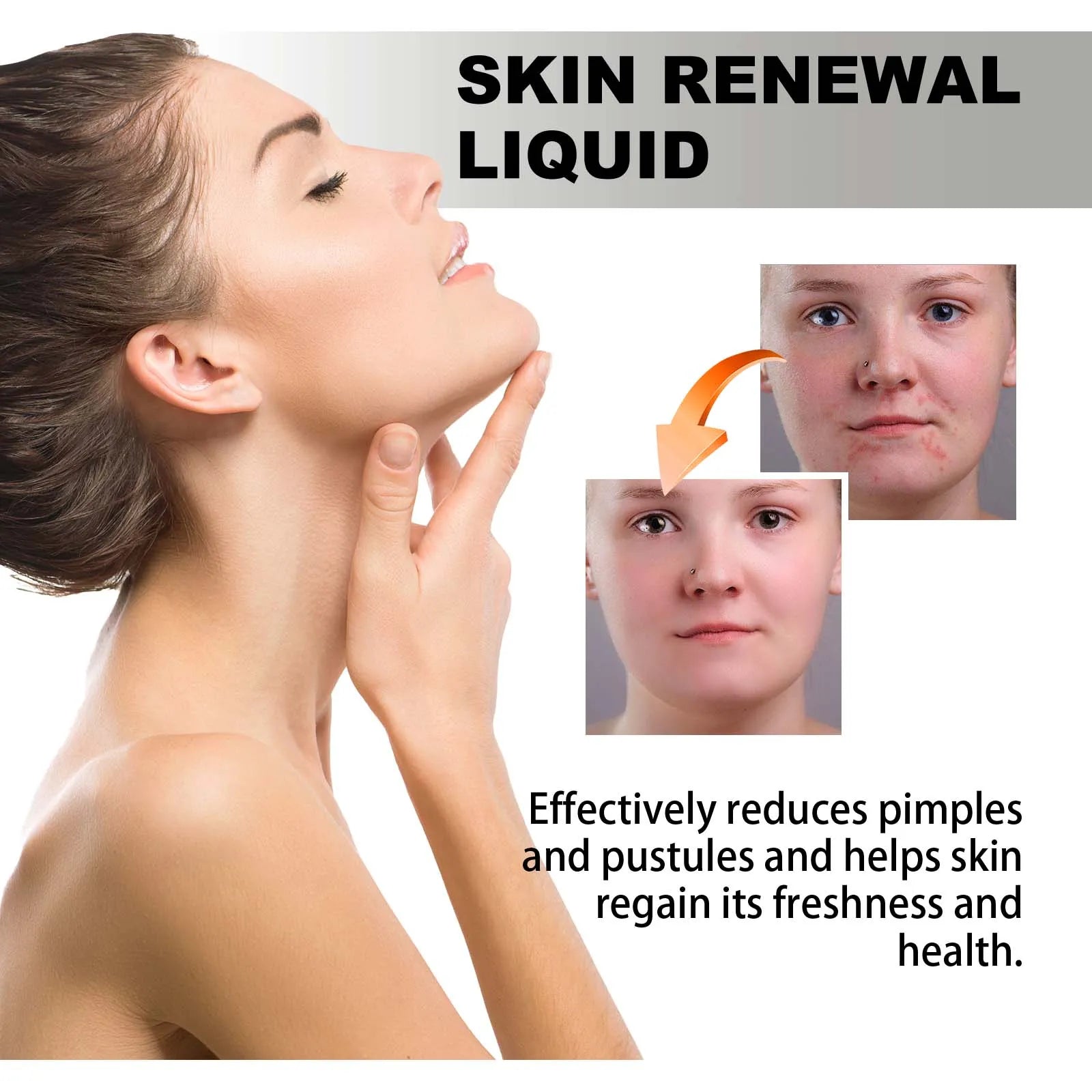2% BHA Salicylic Acid Serum – Acne, Pores & Dark Spots | 118ml BHA Acne Serum Oasis Select