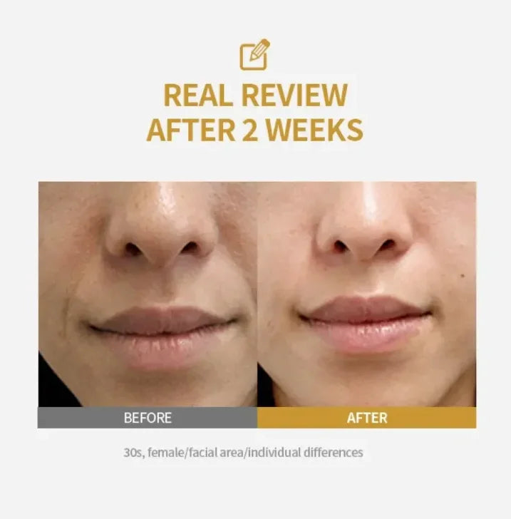 Kojic Acid & Niacinamide Brightening Serum | Dark Spot Corrector Brightening Face Serum Oasis Select