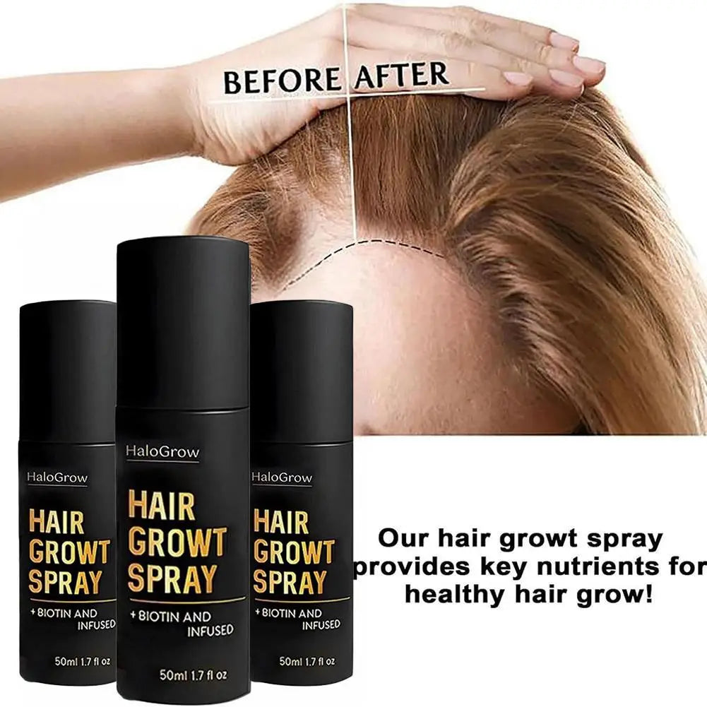 Natural Hair Growth Spray With Ginger Oil and Biotin, Scalp Treatment for Thicker Fuller Hair, Prevent Hair Thinning & Hair Loss Oasis Select