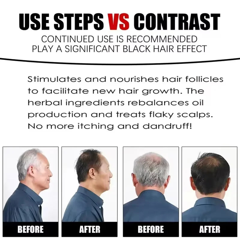Herbal Hair Dye Shampoo – Natural Black & Grey Coverage Hair Dye Shampoo Oasis Select