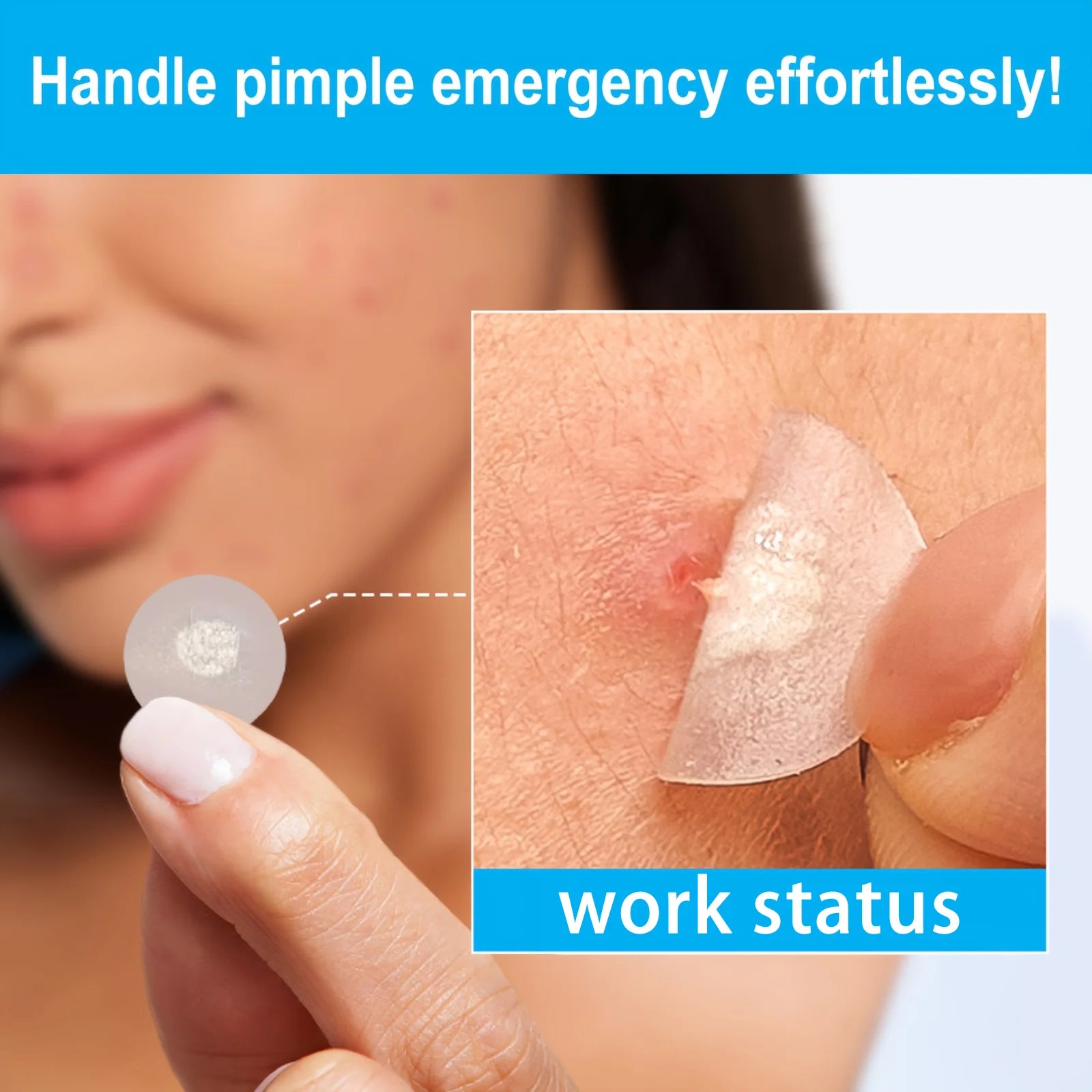 252/412/812pcs circular acne patches. Suitable for all kinds of light skin color, 24-hour protection, invisible coverage, non ir Oasis Select