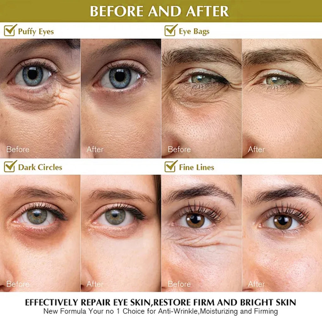 Retinol & Hyaluronic Acid Eye Cream – Anti-Aging & Dark Circles Anti-Aging Eye Cream Oasis Select