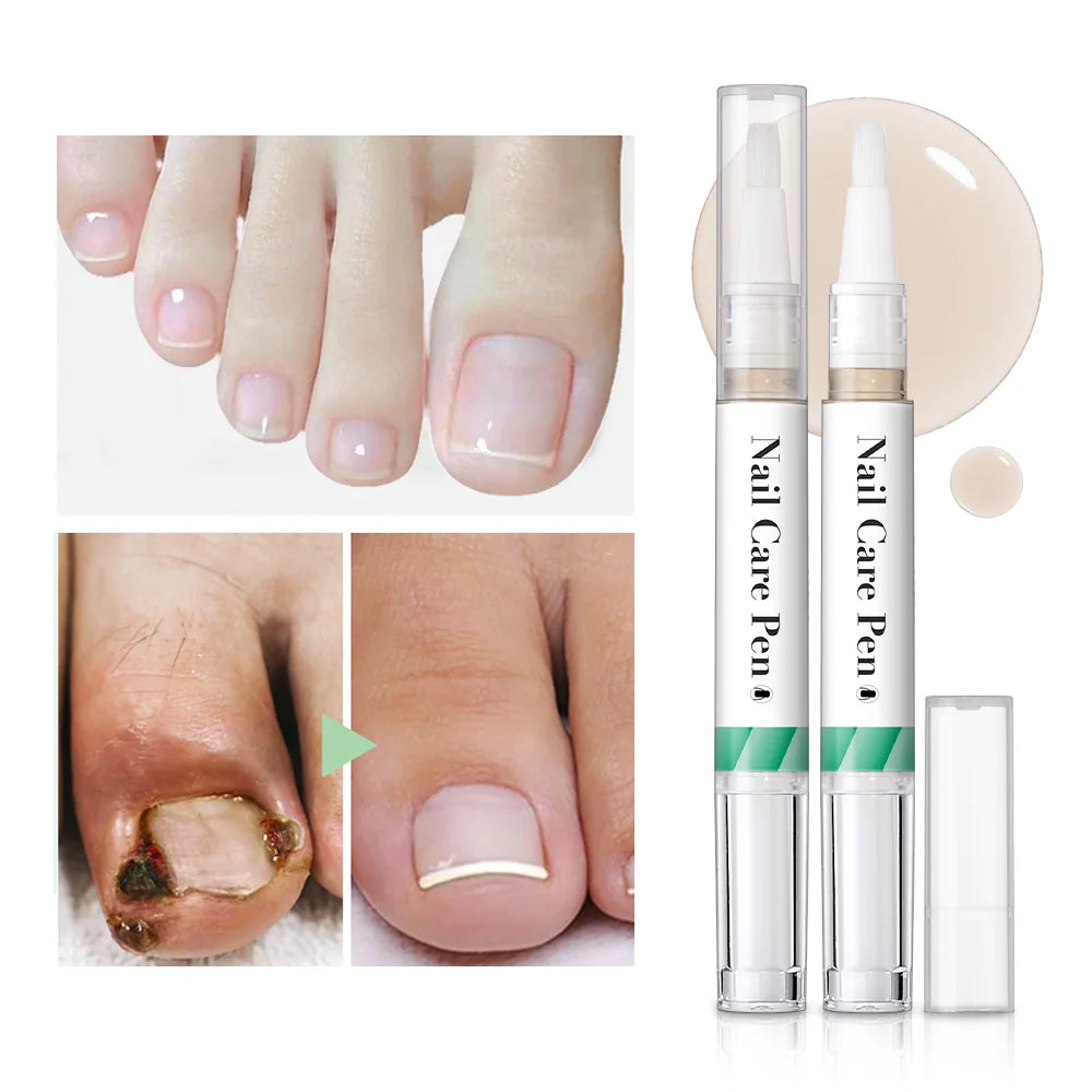 Nail Growth Oil Nail Treatment Cuticle Revitalizer Oil Prevent Agnail Nail Polish Nail Nutrition Oil Pen Manicure Nail Repair Oasis Select
