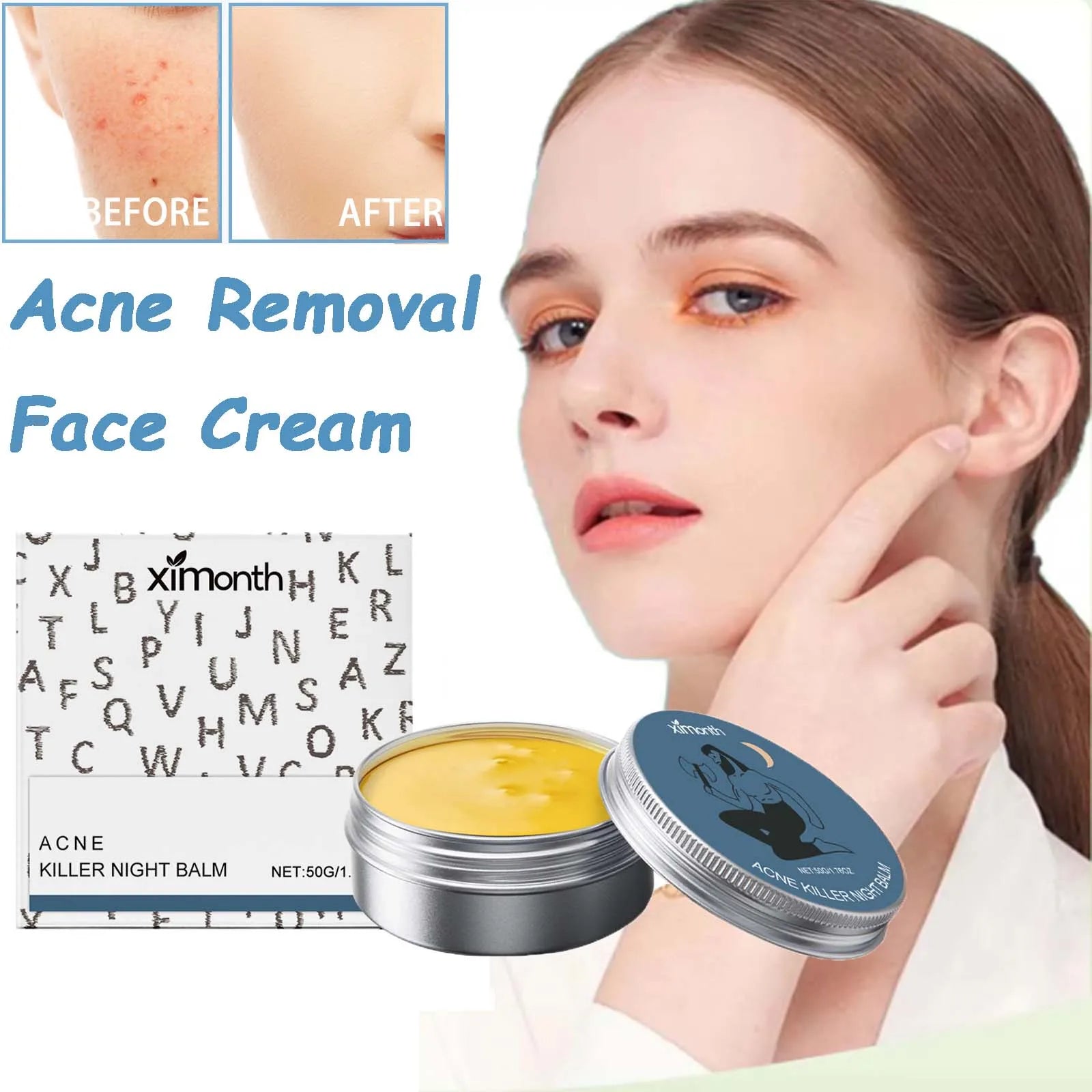 Acne Removal Face Cream Gently Balances Skin Oil Refreshing Skin Care Shrink Pores Oil Control Hydrating Anti Acne Cream Oasis Select