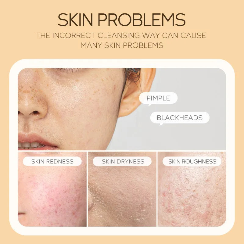120ml Vitamin C Cleansing Mousse Facial Care Cleansing Pore Brightening Skin Tone Shrinking Pore Facial cleanser Skin care Oasis Select