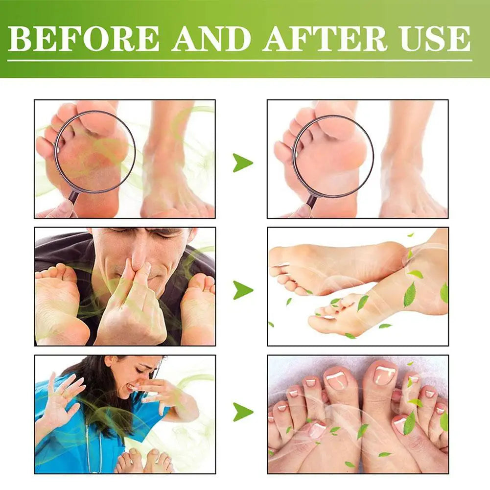 30ml Natural Foot & Shoe Deodorizer Spray | Fresh Dry Feet Foot Deodorizer Spray Oasis Select