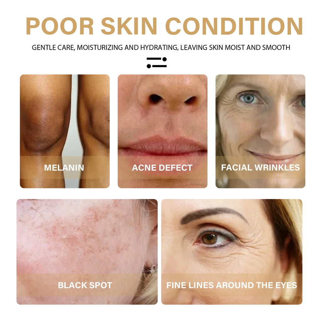 Eelhoe Turmeric Serum – Fades Dark Spots & Brightens Skin