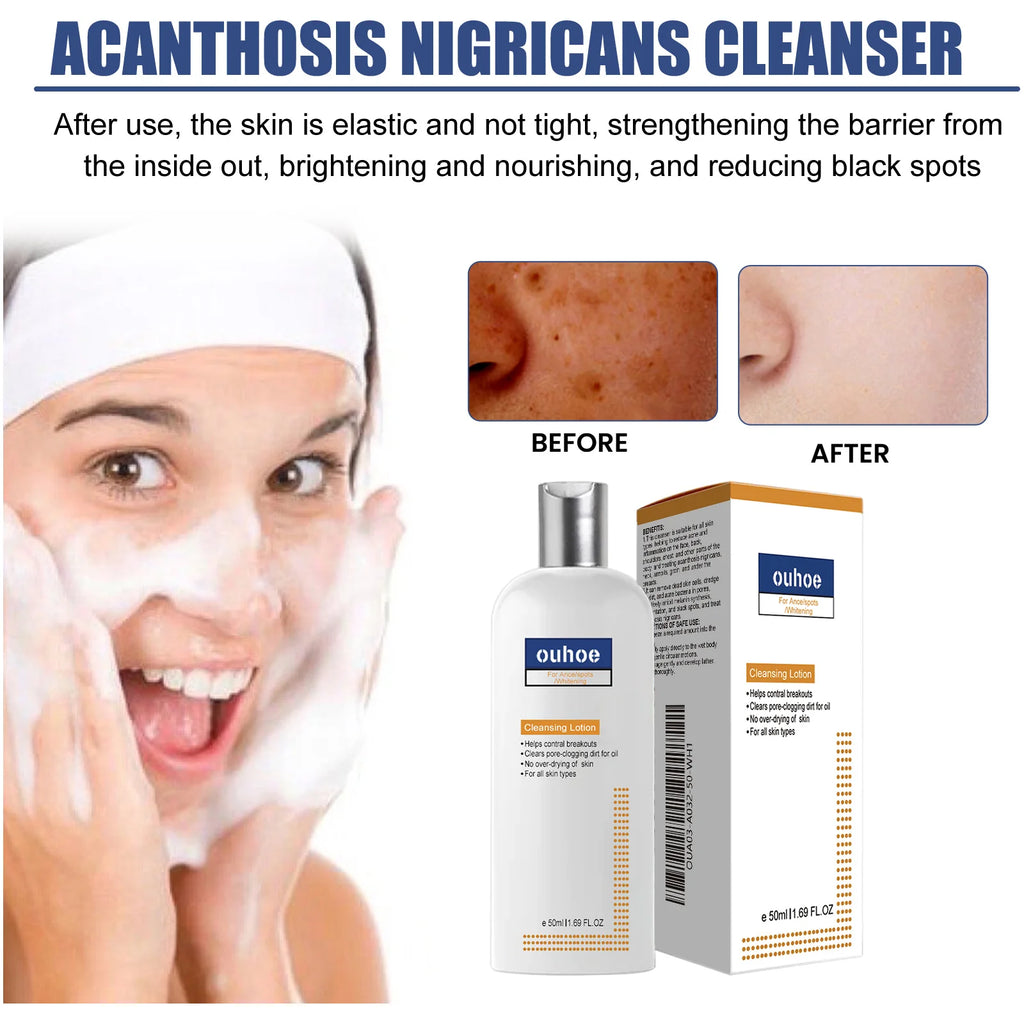 Brightening Facial Cleanser Remove Acne Dark Spots Melanin Oil Control Skin Cleansing Face Wash Blackhead Remover Face Cleaner Oasis Select
