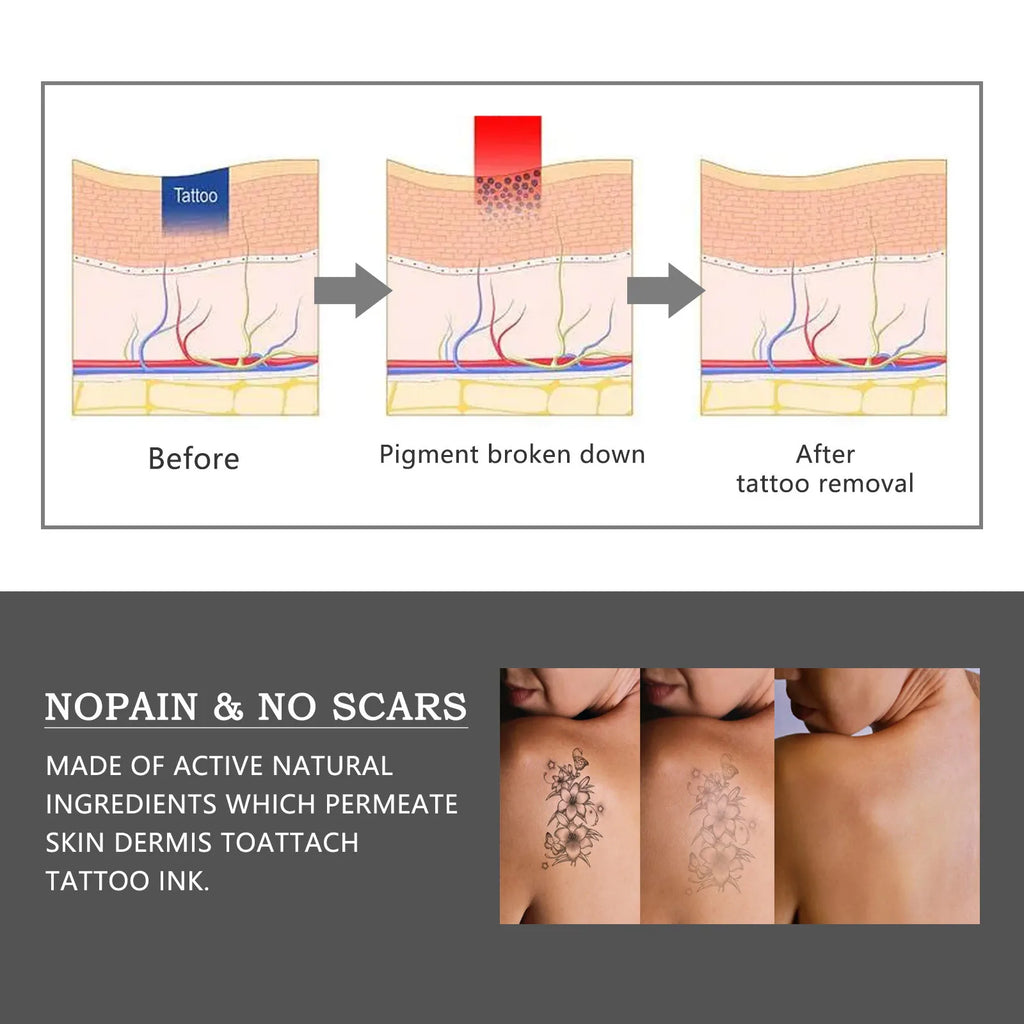 Jaysuing Tattoo Fading Cream – Body, Brows & Lip Pigment Fade