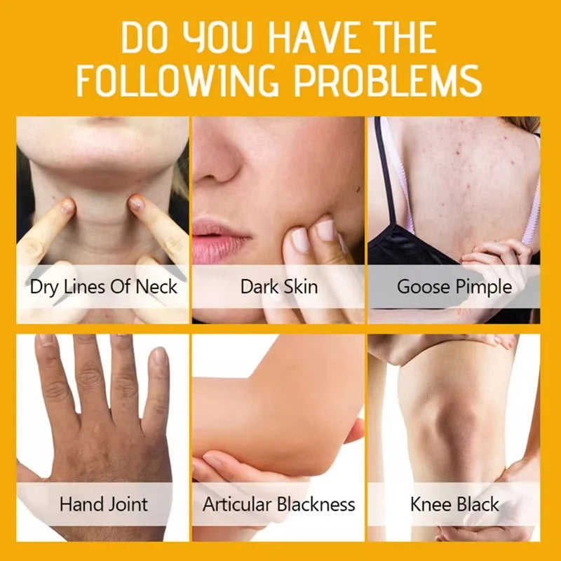 Strong Yellow Peeling Oil Bleach Dark Skin Whiten Lotion Lighten Body Elbow Knee Hand Exfoliate Dead Skin Nourish Even Skin Tone Oasis Select