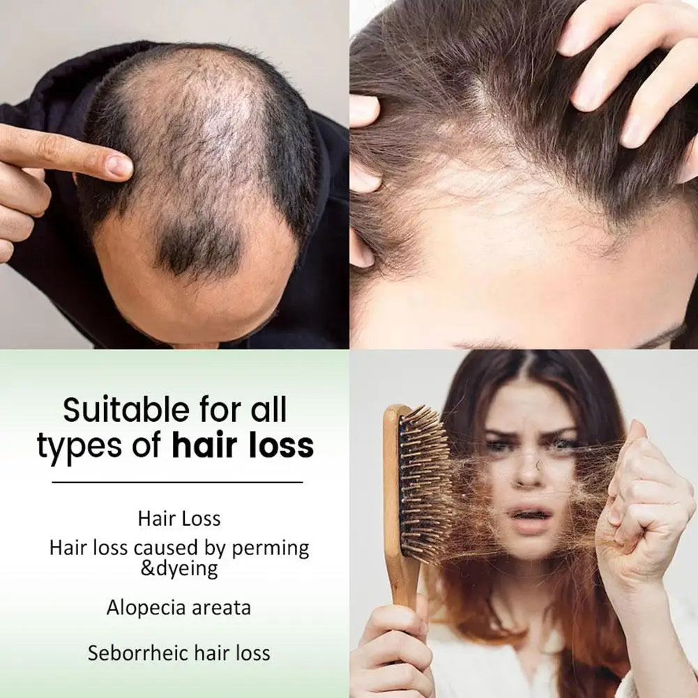 Rosemary Shampoo – Volumizing, Thickening & Oil Control Rosemary Hair Shampoo Oasis Select