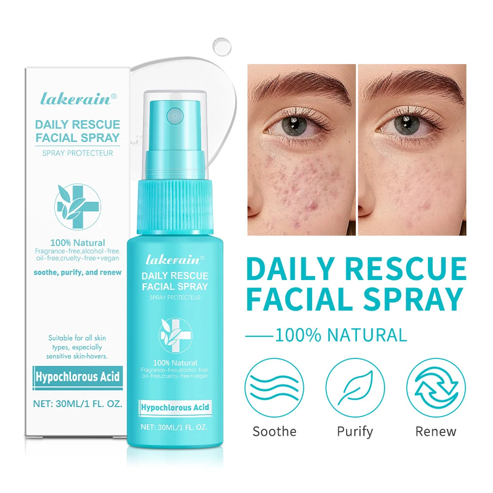 PH Balancing Toner Daily Rescue Facial Spray for Sensitive Skin Hypochlorous Acid Spray Helps Reduce Redness Breakouts Soothing Oasis Select Default Title