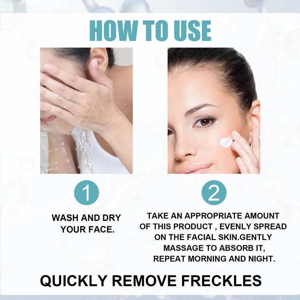 Eelhoe Dark Spot Corrector Cream – Niacinamide & Retinol 30g Dark Spot Corrector Oasis Select