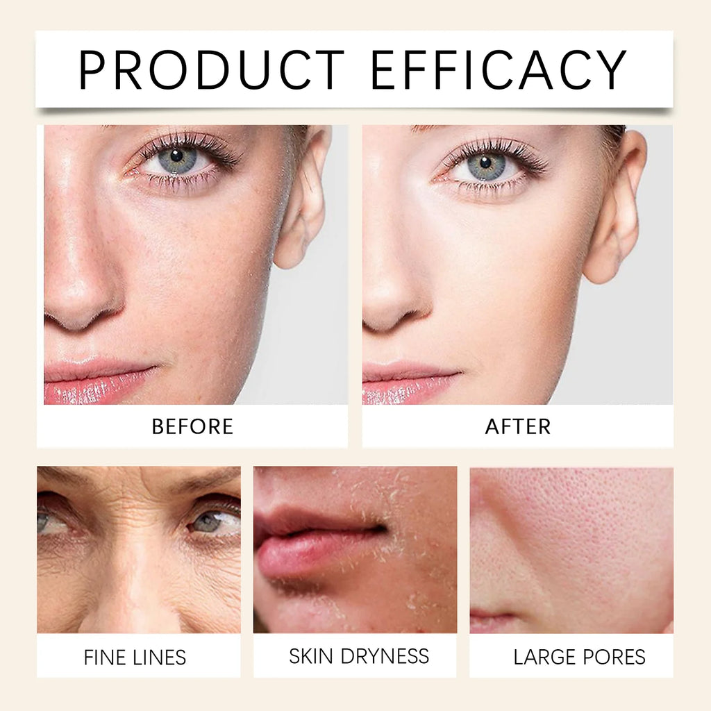 Eelhoe Oat Face Moisturizer – Soothing Blemish Relief Cream Face Moisturizer Cream Oasis Select