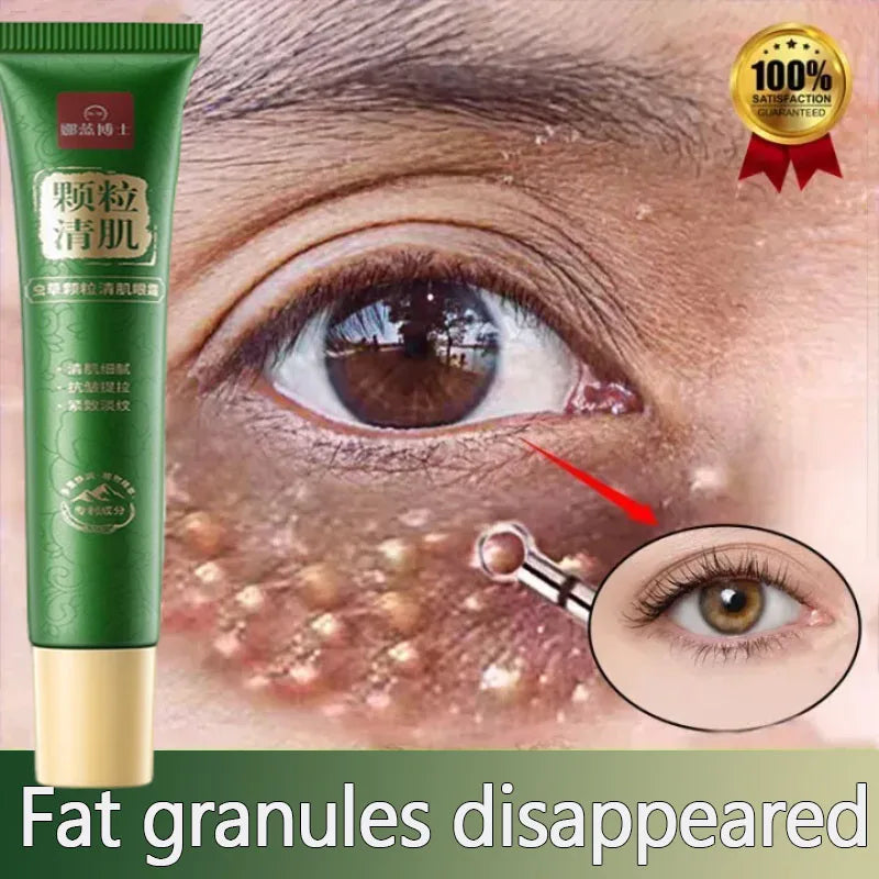 Fat Granules Remover Eye Cream Anti-Puffiness Anti Inflammatory Reduce Dark Circles Eyebags Fade Lines Moisturizing Eye Care Oasis Select