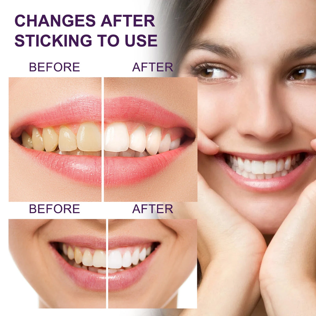 v34 Purple Toothpaste Teeth Whitening & Stain Removal Prevents Yellowing Brightens for Radiant Smiles Breath Oral Oasis Select