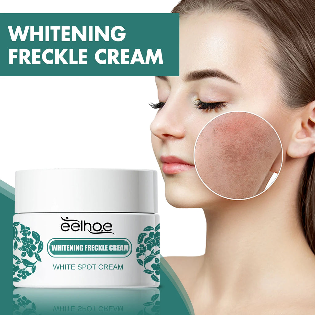 EELHOE Niacinamide Freckle & Melasma Removal Cream 30g