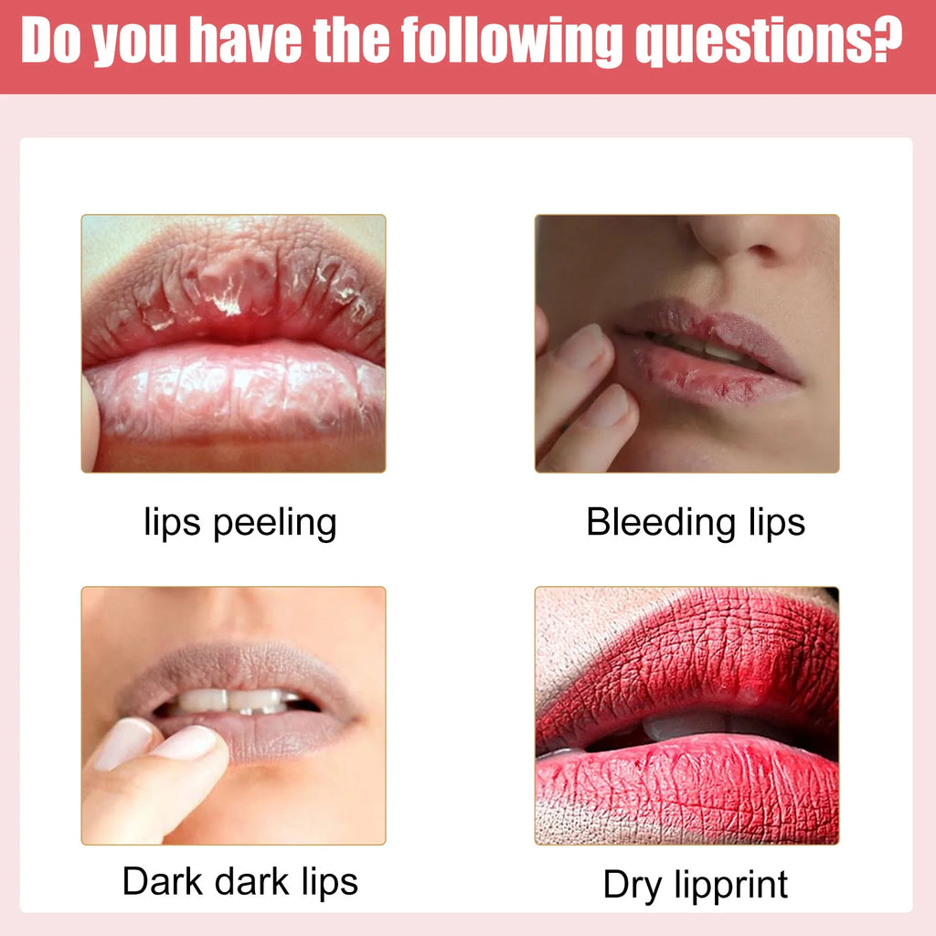 EELHOE Lip Brightening Cream – Lighten Dark Lips & Moisturize Lip Treatment Cream Oasis Select
