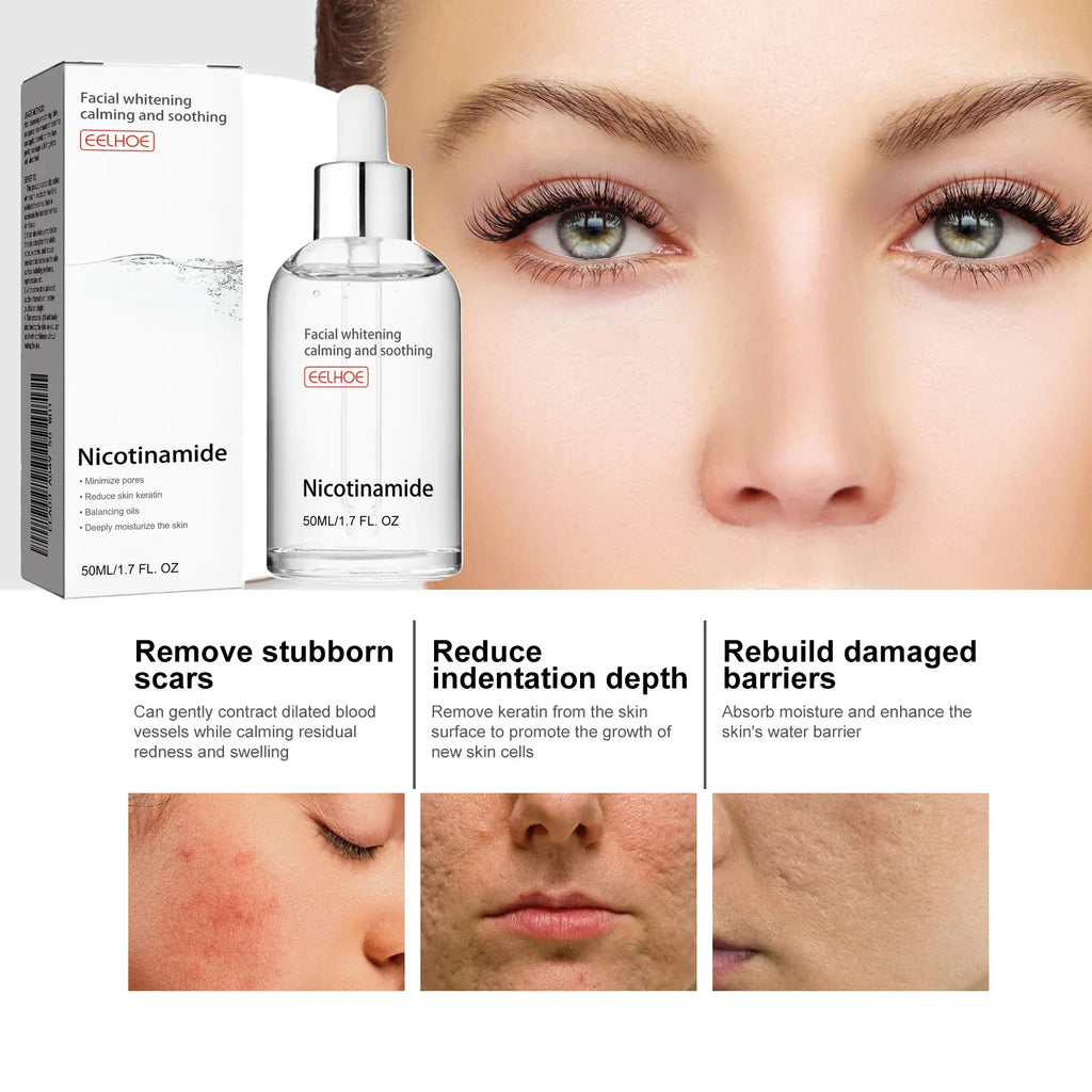 Eelhoe Niacinamide Face Serum – Fade Dark Spots & Brighten Skin Brightening Face Serum Oasis Select