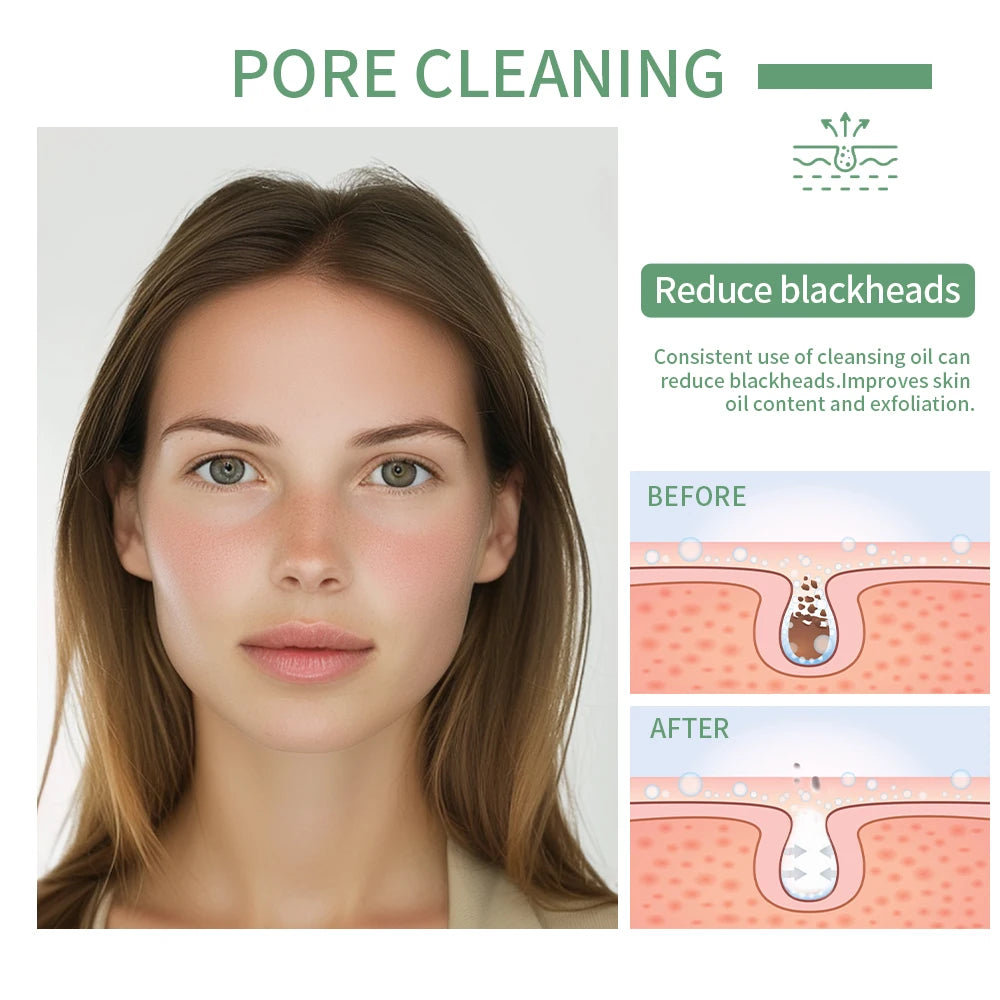 Deeply Cleansing Oil Instant Makeup Removal Refreshing Non Irritating Removal Cleansing Oil Sensitive Skin Care Oasis Select
