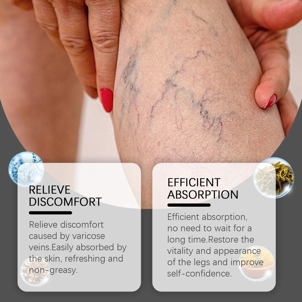 OceAura Varicose Veins Relief Cream – Spider Veins & Leg Pain Varicose Vein Cream Oasis Select