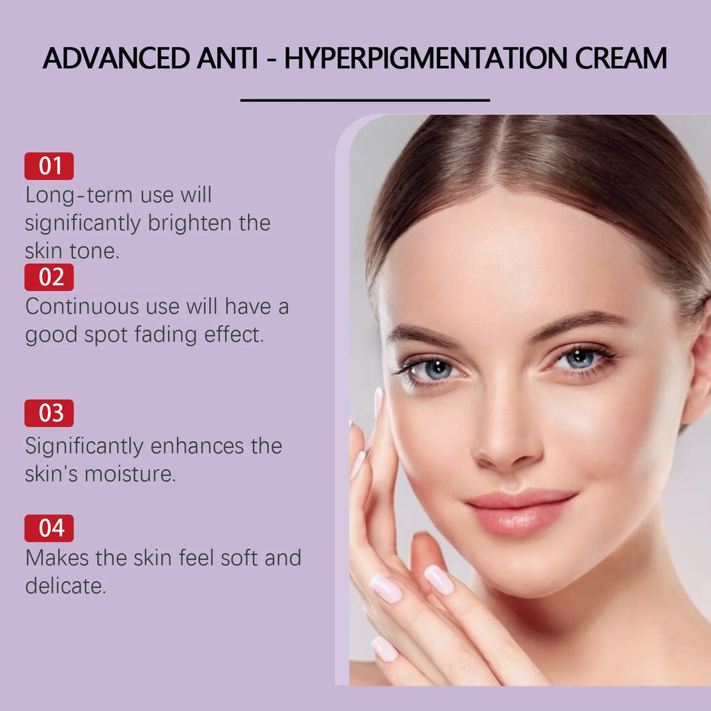 HOUKEA Whitening Freckle Cream – Dark Spots & Melasma Brightening Face Cream Oasis Select