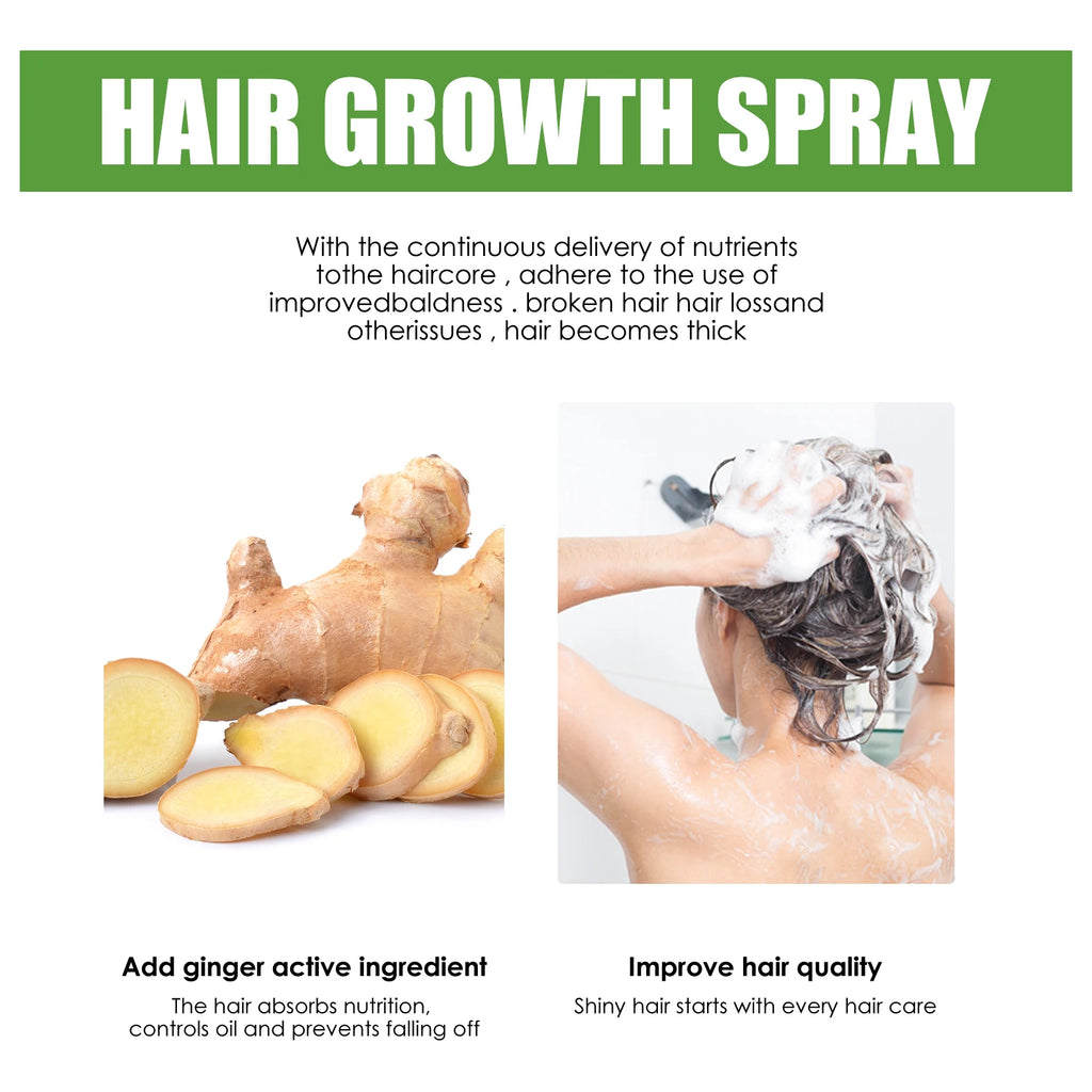 Ginger Hair Growth Spray – Anti-Baldness Scalp Treatment Hair Growth Spray Oasis Select