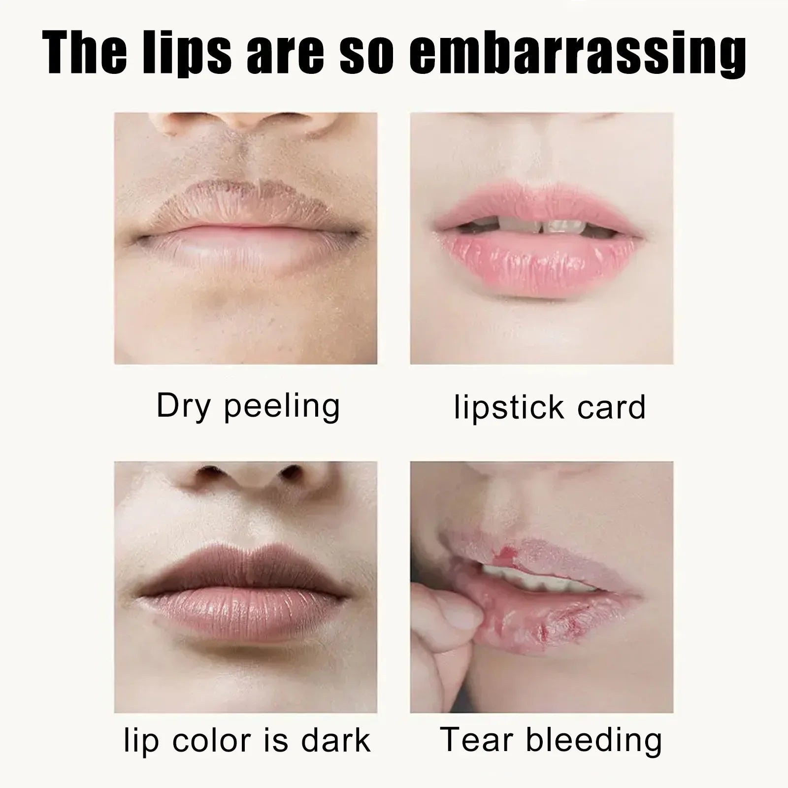EELHOE Cherry Lip Mask – Moisturize, Fade Lines & Repair (5pk) Lip Mask Treatment Oasis Select