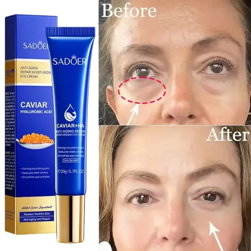 Caviar & Hyaluronic Acid Eye Cream – Firming & Brightening 20g