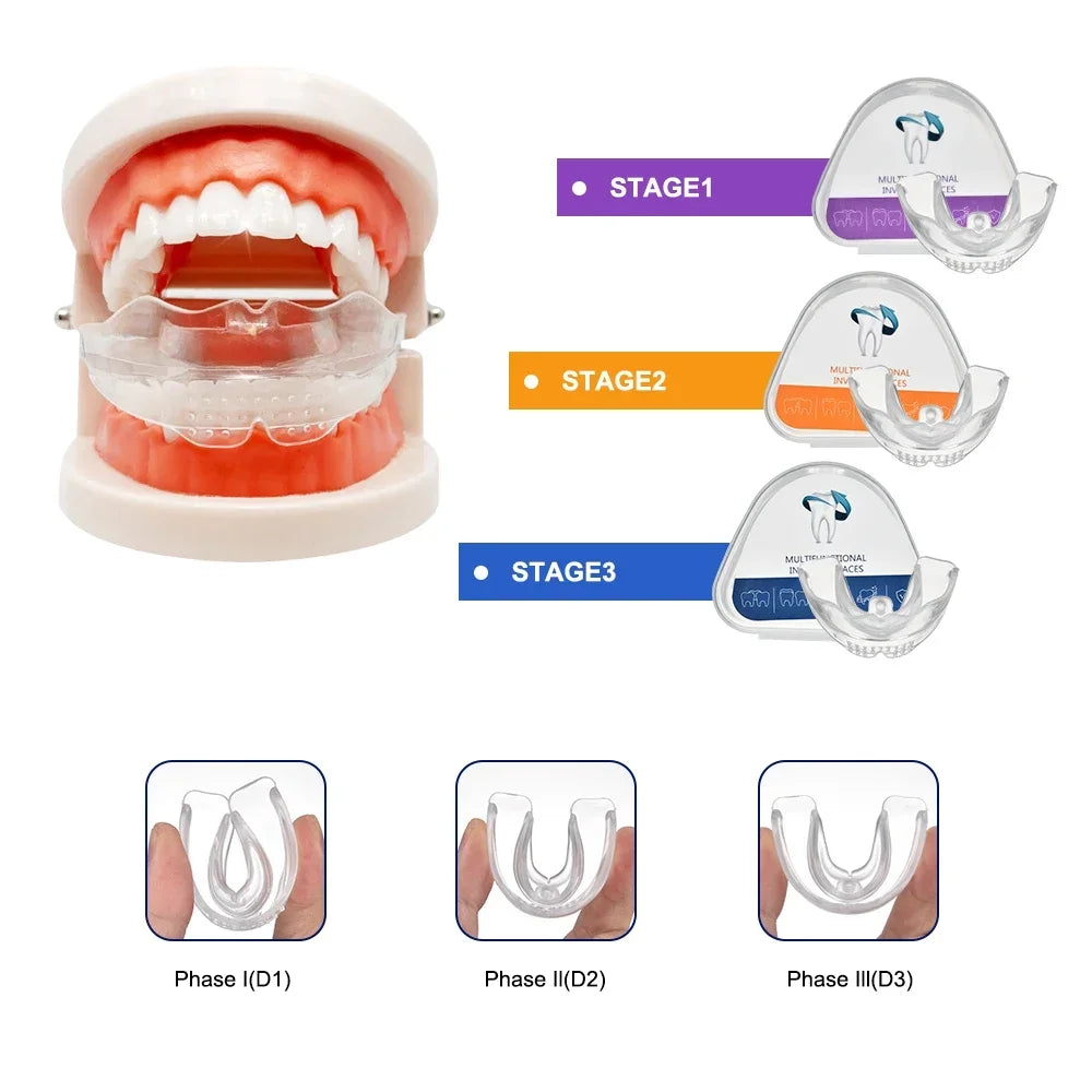 3-Stage Transparent Teeth Trainer Braces for Adults | D1 D2 D3