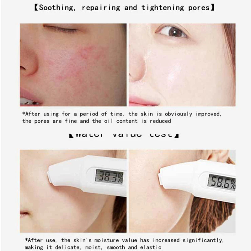 30-Pack Centella Collagen Sleeping Face Mask – Anti-Aging Sleeping Face Mask Oasis Select